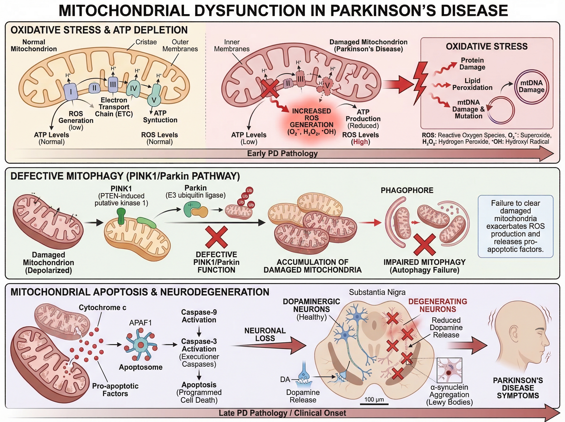Mitochondrial dysfunction plays a crucial role in the pat... | SciDraw ...