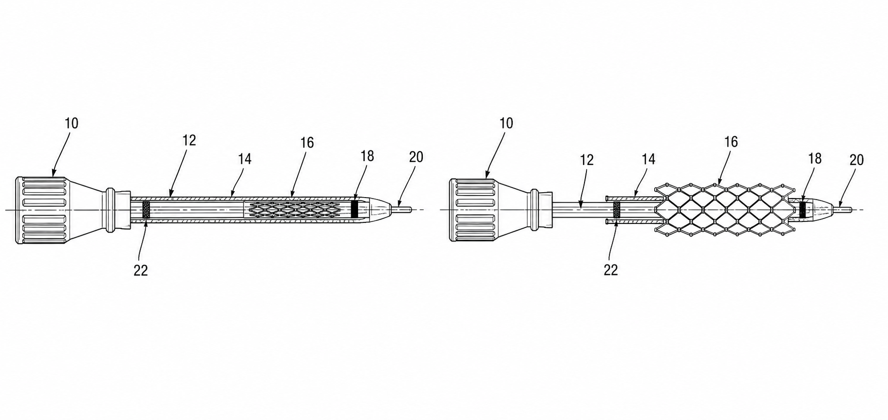 Stent-delivery catheter shown collapsed and deployed with consistent reference numerals